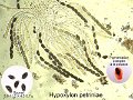 Hypoxylon petriniae-amf67-micro